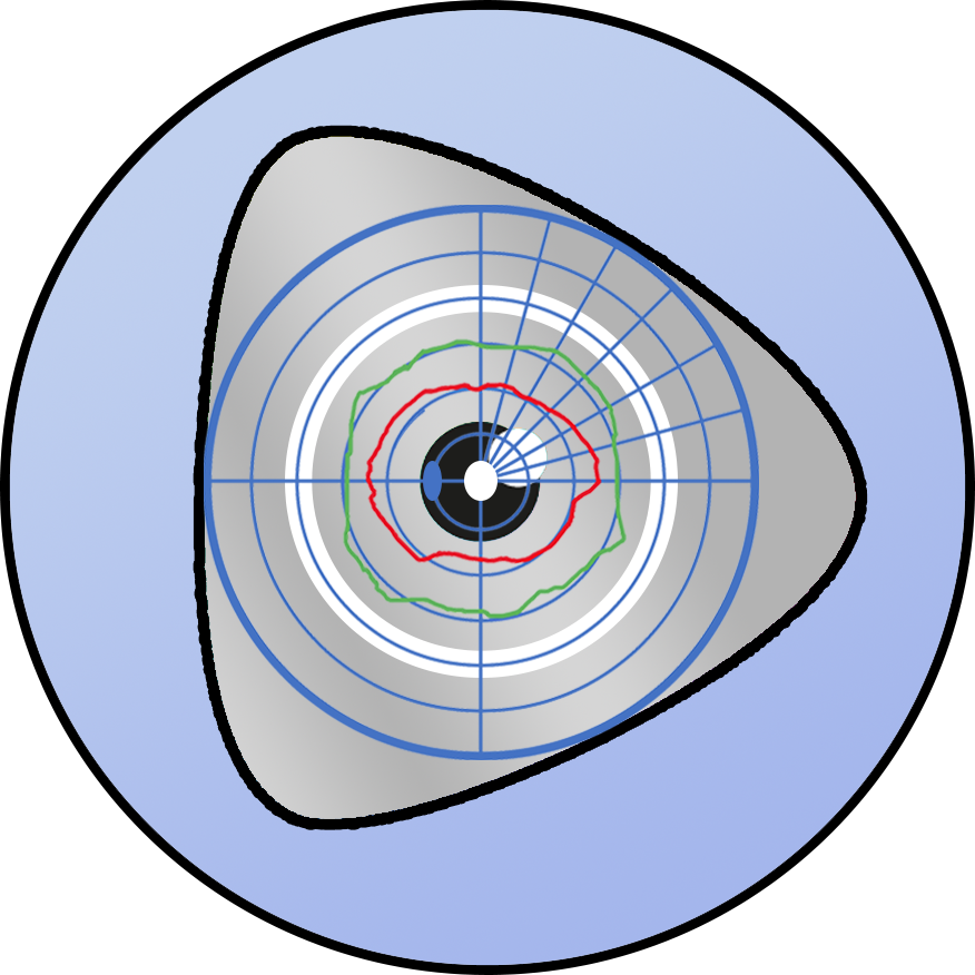 Kinetic Colour Perimetry